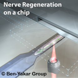 Nerve Regeneration on a chip. An artist�s impression of a <i>C. elegans</i> worm immobilized in the microfluidic chamber, subjected to the process of nano-neurosurgery.