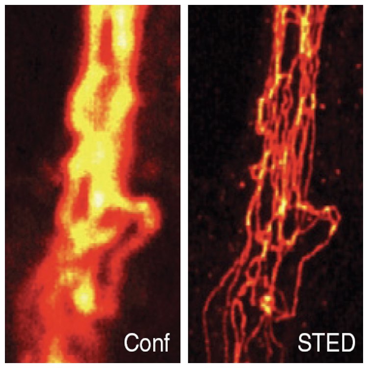 STED vs. Confocal Microscopy. Comparison of confocal (Conf) and STED image of immunolabeled vimentin in a mammalian cell, after linear deconvolution.