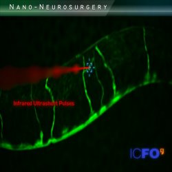 Nano-neuro-surgery. The laser can be used as a ultra-precise scalpel to perform extremely challenging nanosurgery tasks. In the artistic illustration a laser beam is cutting an aberrant union between neurons in a worm.