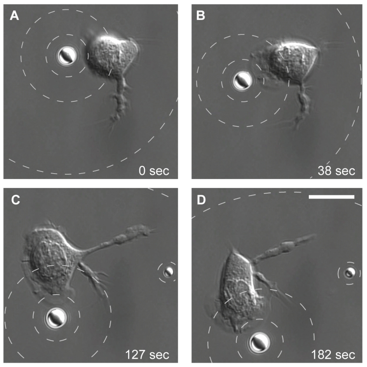 Neutrophil tracks a pseudo-bacterium. A single neutrophil tracks a microbead as it mimics a slow-moving bacterium.